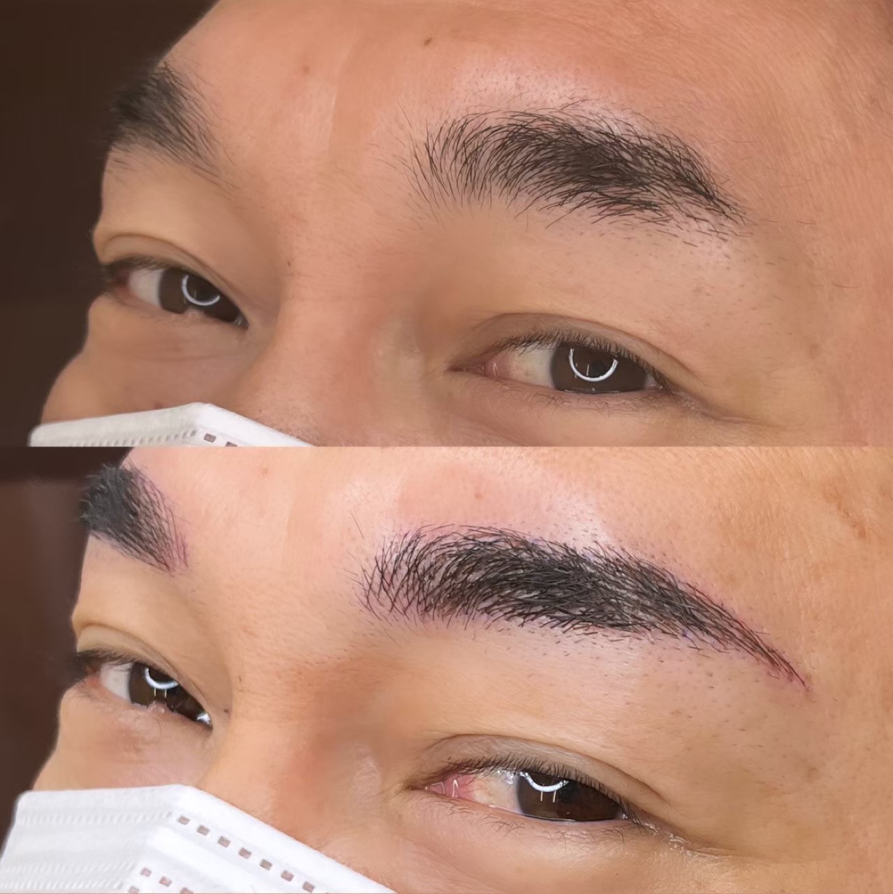 No.3481の症例写真