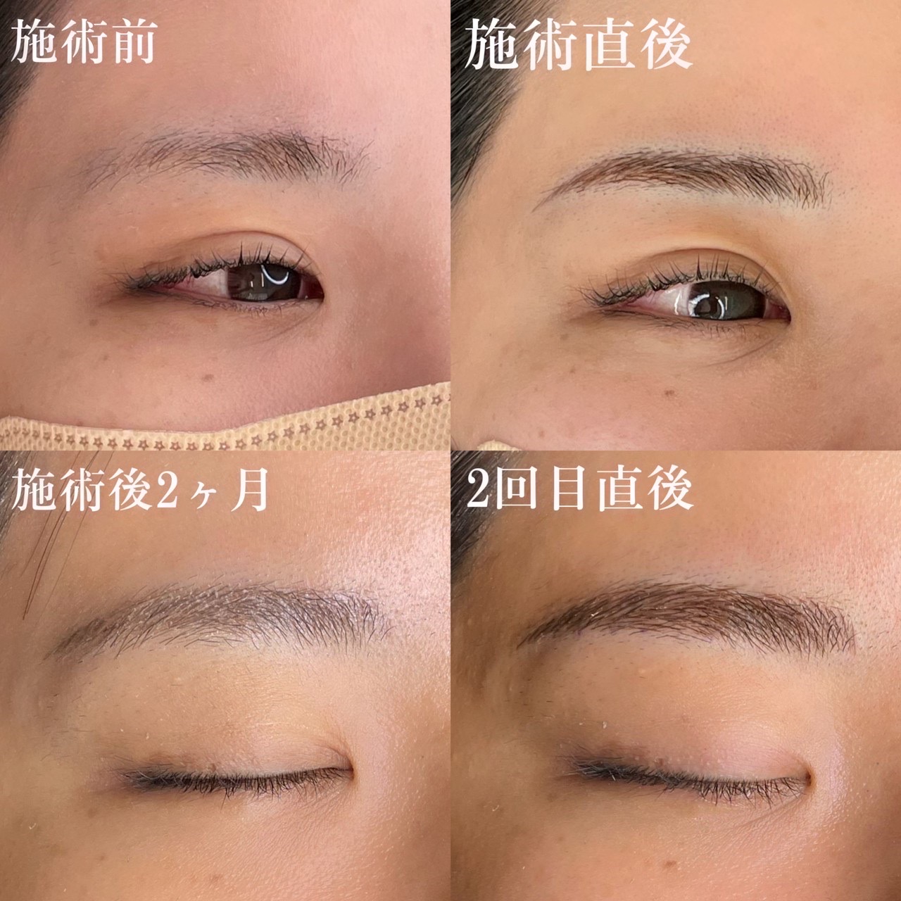 No.3514の症例写真