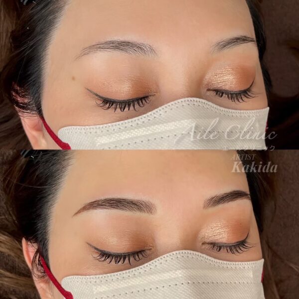 No.3511の症例写真