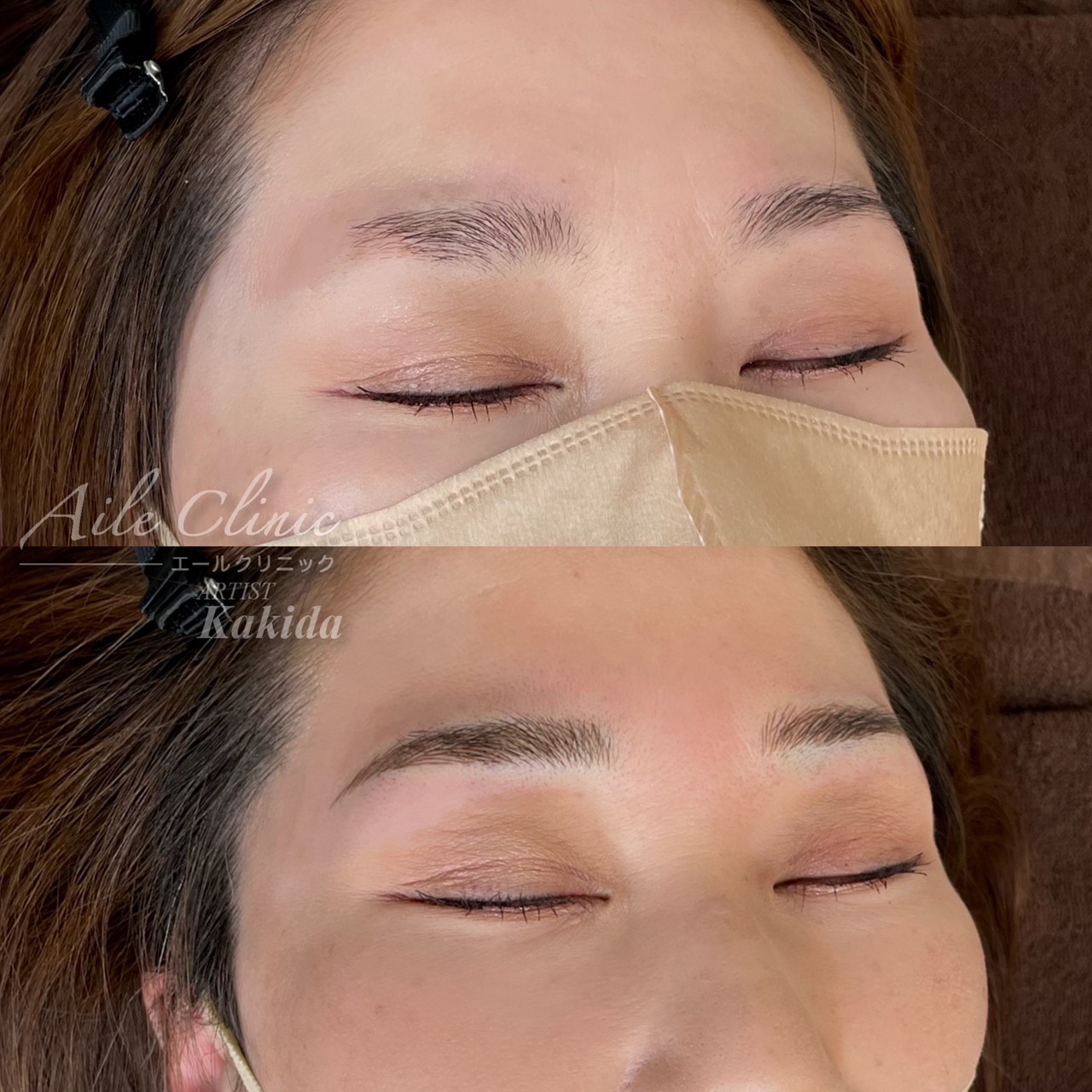 No.3508の症例写真