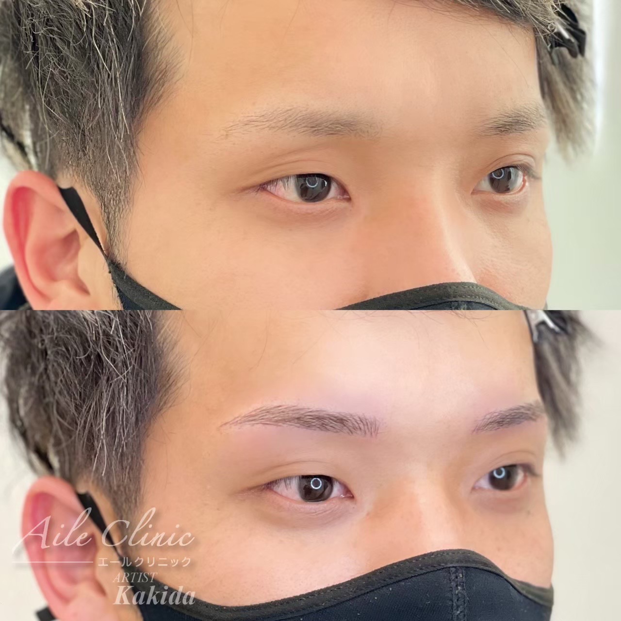 No.3505の症例写真