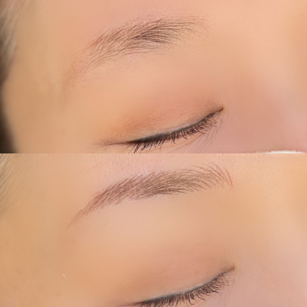 No.3517の症例写真