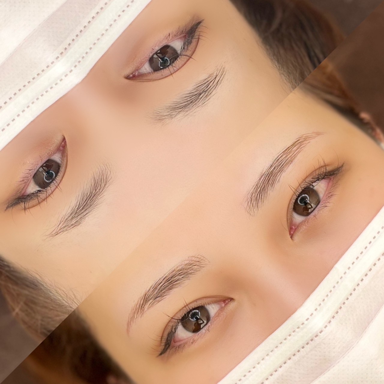 No.3539の症例写真