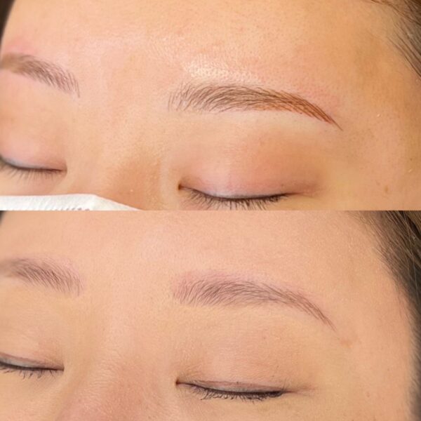 No.3542の症例写真