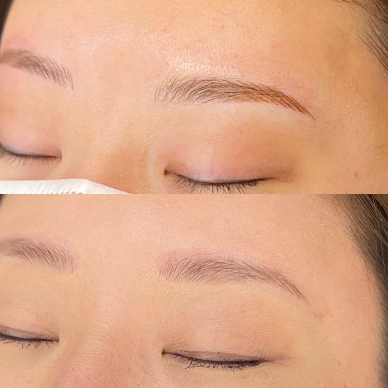 No.3542の症例写真