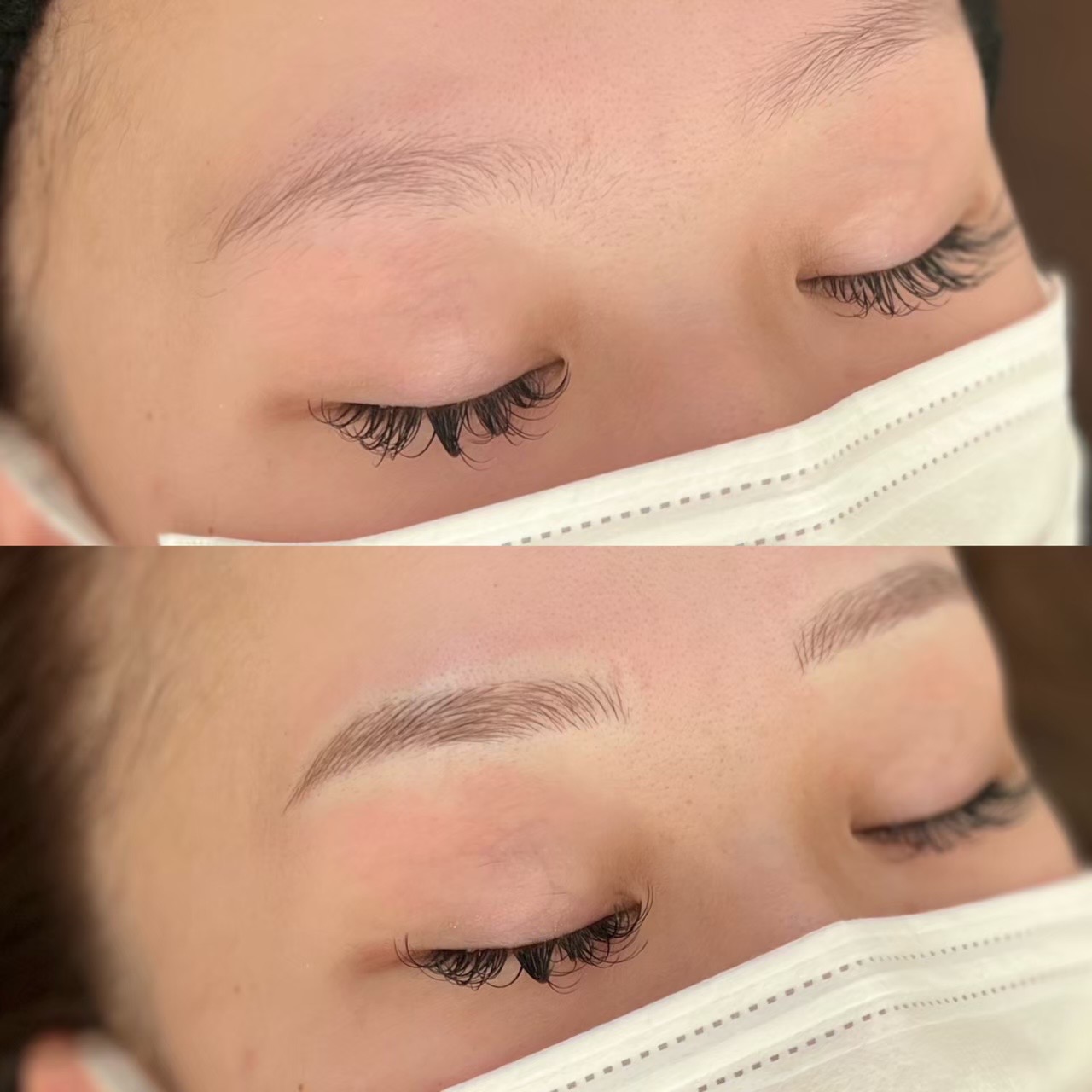 No.3545の症例写真