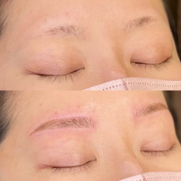 No.3548の症例写真