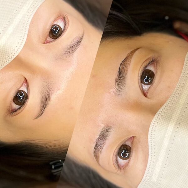 No.3552の症例写真